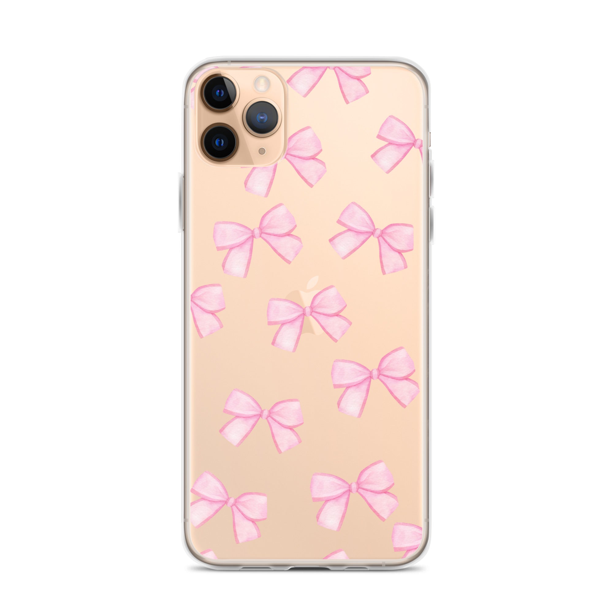 Pink Bows Clear iPhone Case